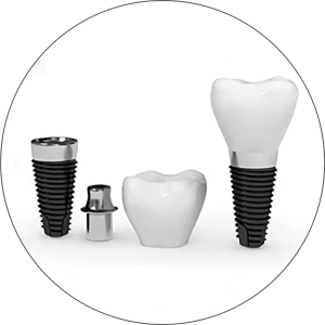 Implantable prototypes