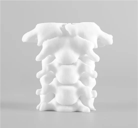 Selective Laser Sintering (SLS) Selective Laser Sintering (SLS)